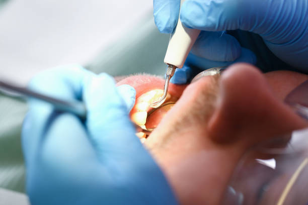 Best Emergency Root Canal Therapy in Garden City, NY