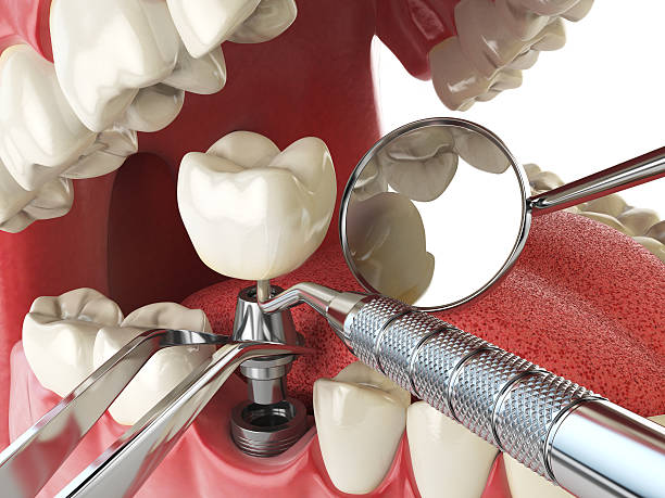 Best Emergency Denture Repair in Garden City, NY